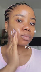 une crème Arbutin 7% + TXA 4%